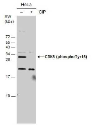 Western Blot: Cdk5 [p Tyr15] Antibody [NBP3-12917] - Untreated (-) and treated (+) HeLa whole cell extracts (30 ug) were separated by 15% SDS-PAGE, and the membrane was blotted with Cdk5 (phospho Tyr15) antibody (NBP3-12917) diluted at 1:4000.